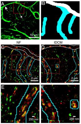 Nanoscale Organisation of Ryanodine Receptors and Junctophilin-2 in the Failing Human Heart